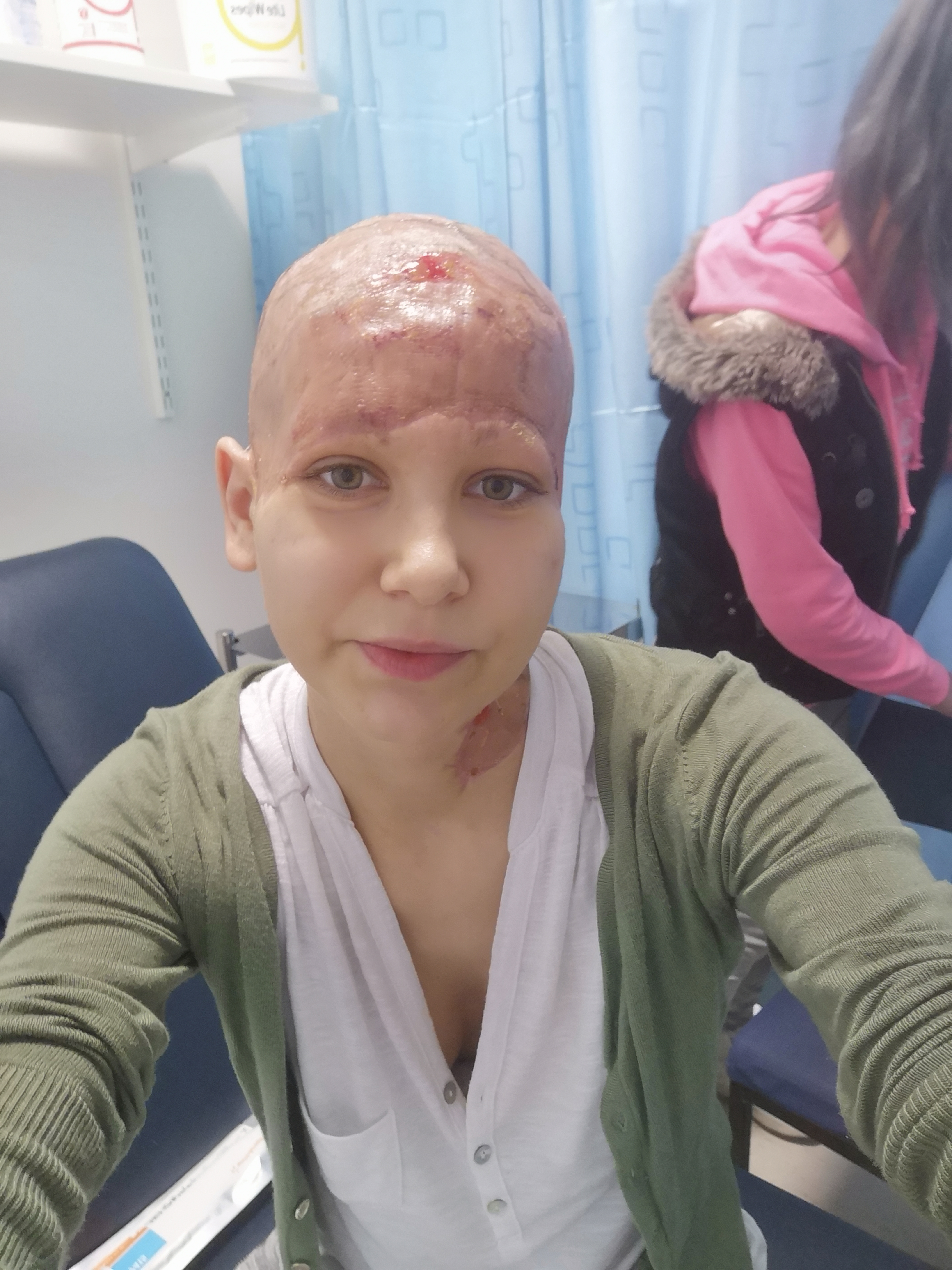 He had an operation in which he had his ear removed.