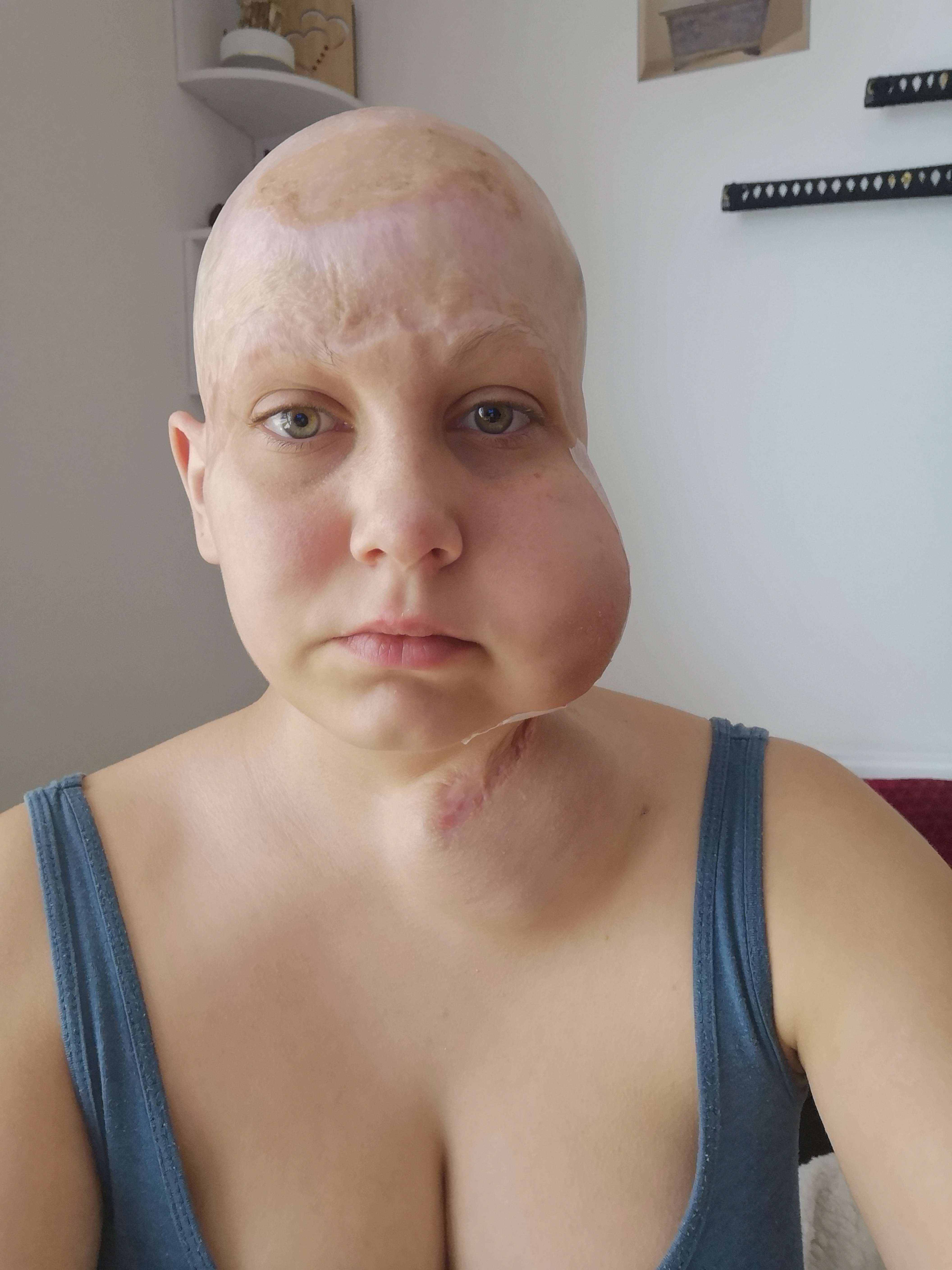 The firm was fined 62 62,000 after admitting to violating health and safety guidelines after the trial.