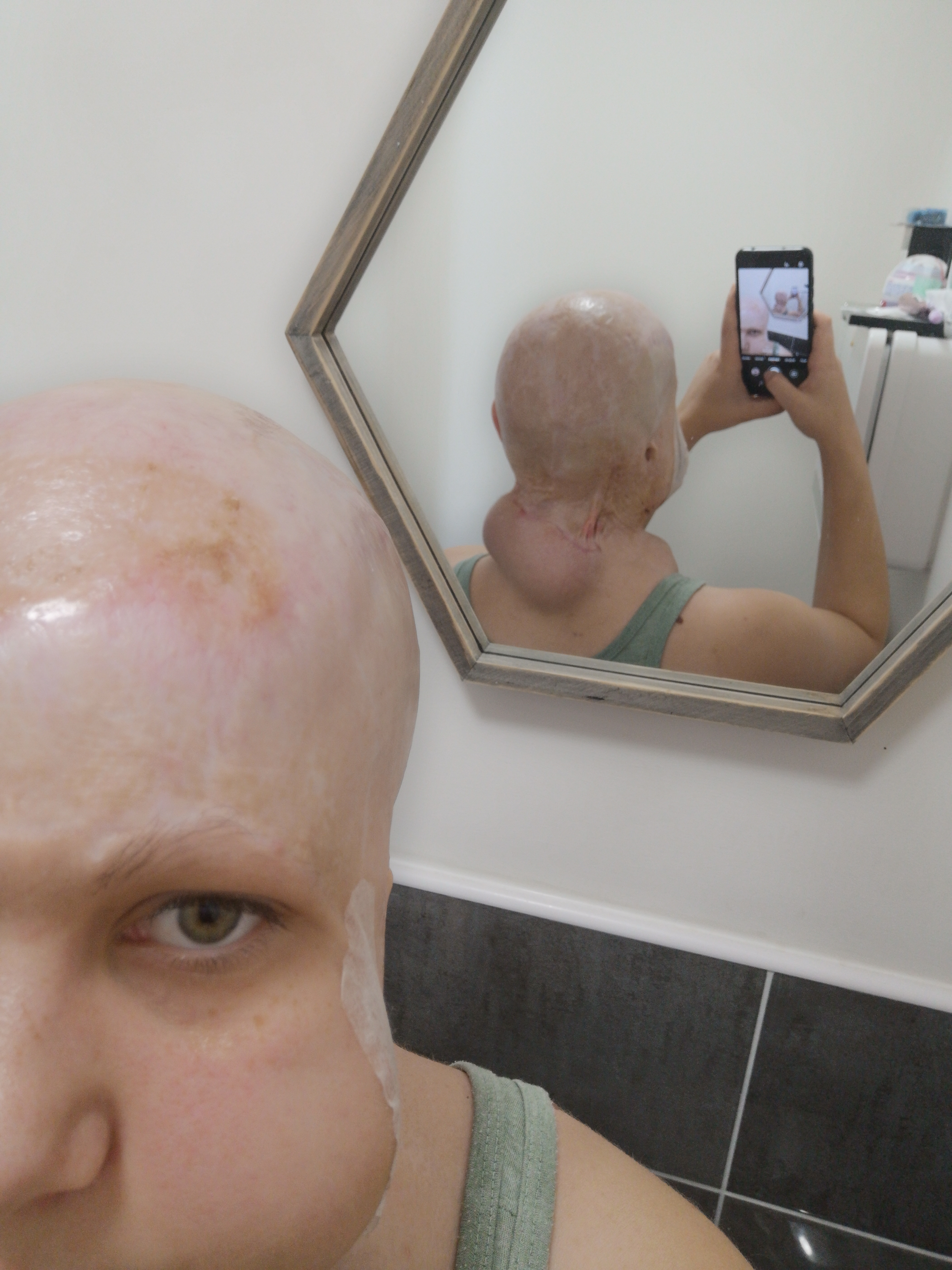 She says she feels like a prisoner in her own home.